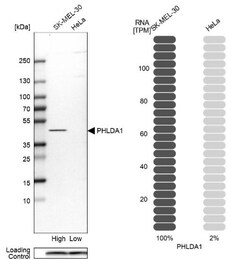 PHLDA1 Antibody, Novus Biologicals 0.1mL; Unlabeled:Antibodies, Polyclonal